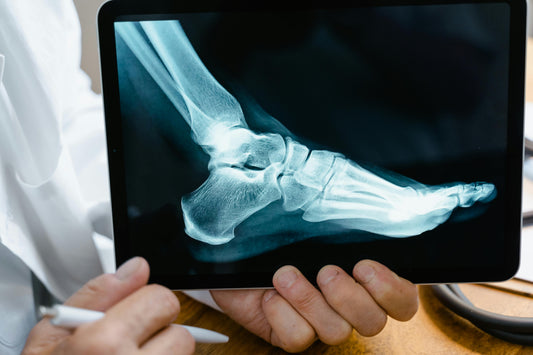 The Truth About Your Sports Shoes: Game-Changer or Injury-Maker?